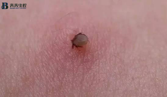 解读蜱虫预防与处理，值得收藏！