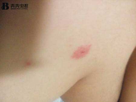 对抗蚊子块的&ldquo;终极武器&rdquo;究竟是什么？