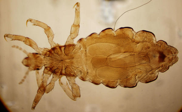 家里为什么有书虱？书虱如何治？